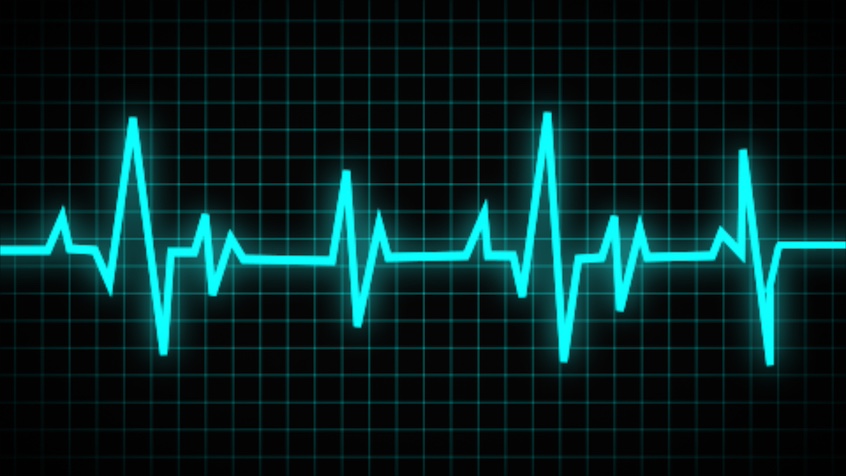 Der EKG-Ausschlag einer Herzfrequenz in Blau auf schwarzen Grund.